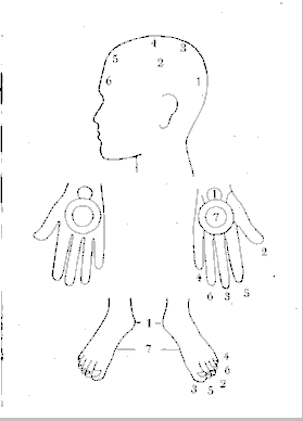 The head, hands and feet will testify against owner